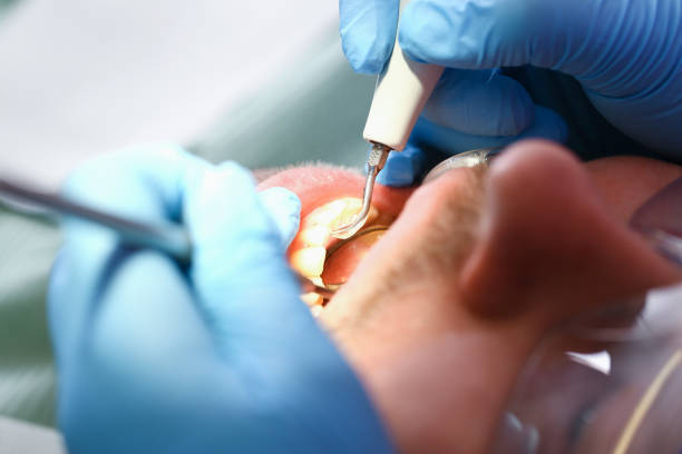 Best Emergency Dental Care for Broken or Chipped Teeth in Mount Ida, AR